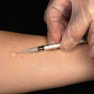 child vaccination in sikar